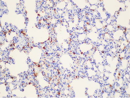 Galectin 3 Polyclonal Antibody