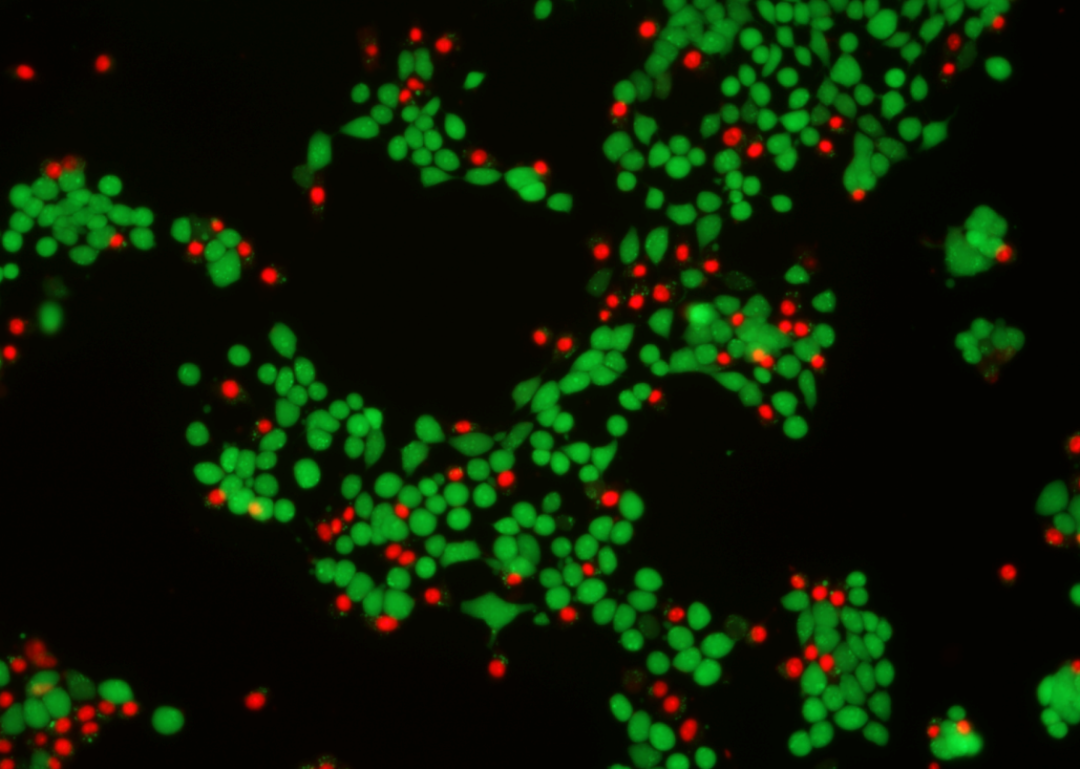 4T1细胞5μM喜树碱处理4h后，染色结果展示