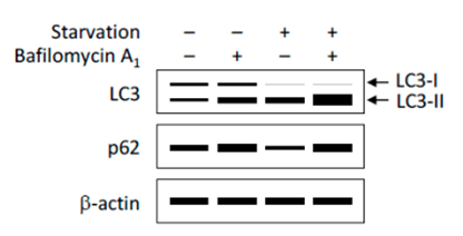WB检测LC3、p62蛋白的表达