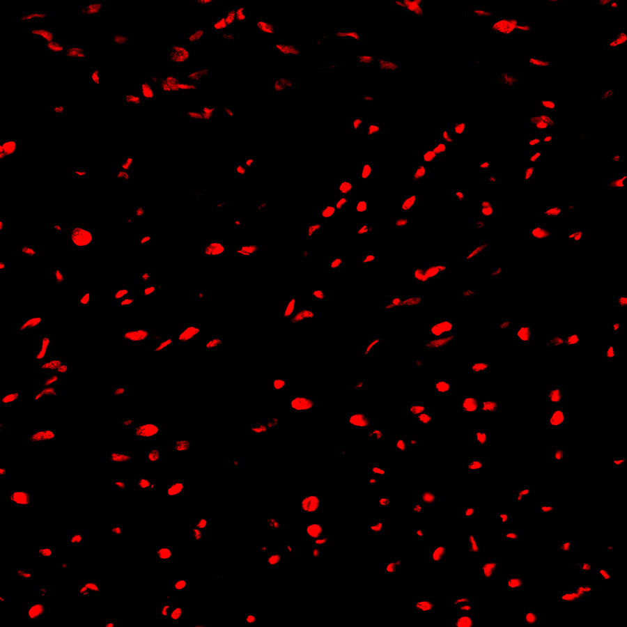 Paraffin embedded mouse heart was treated with DNase I to fragment the DNA. DNA strand breaks showed intense fluorescent staining in DNase I treated sample (red).