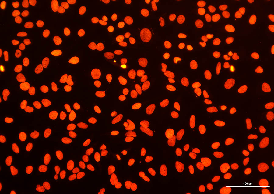 Hela cells was treated with DNase I to fragment the DNA. DNA strand breaks showed intense fluorescent staining in DNase I treated sample.(Red)