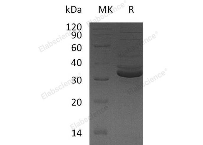 Recombinant Human GPD1/GDP-C Protein(C-6His)-Elabscience