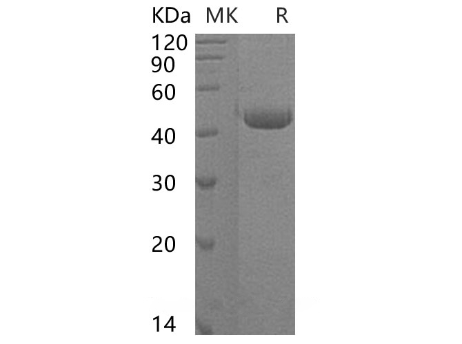 Recombinant Human ST6 Sialyltransferase 2/ST6GalNAc2 Protein(C-6His)-Elabscience