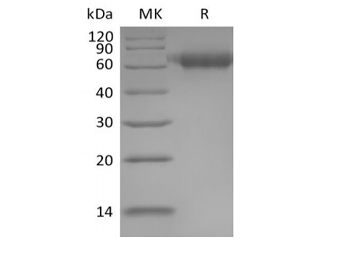 Recombinant Human IL-1 Receptor Accessory Protein/IL-1RAcP/IL-1R3 (C-6His)