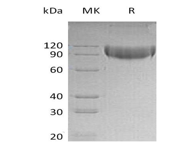 Recombinant Mouse L-selectin / SELL Protein (C-His)-Elabscience
